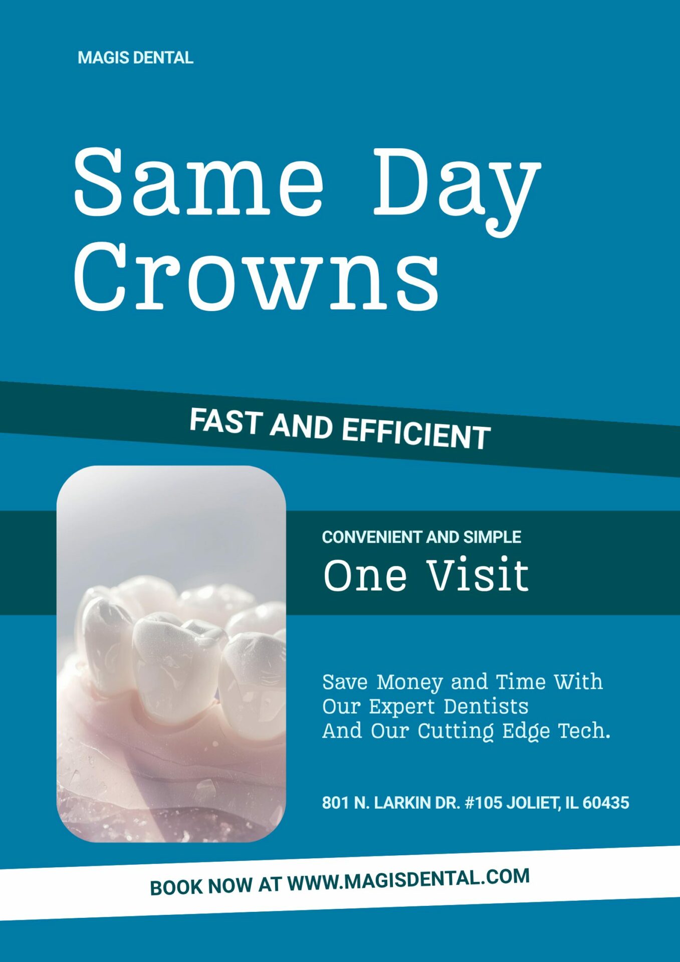 Same day crowns at Magis Dental in Joliet, IL 60435