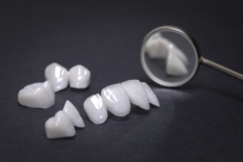 White fillings are a wonderful alternative to the traditional metal cavity repairs most dentist offer.