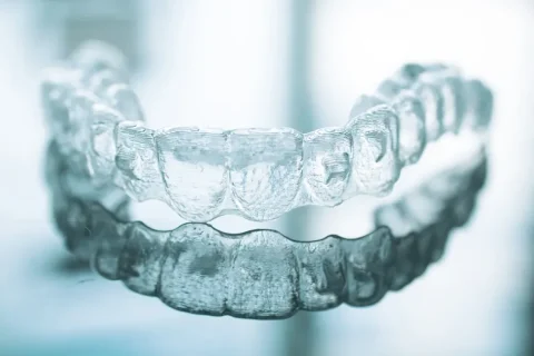 Invisalign Clear Aligners