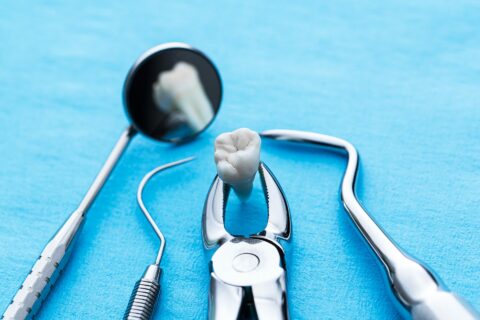 Tooth extraction at Magis Dental, in Joliet, IL are painless and simple with Dr. Burns.