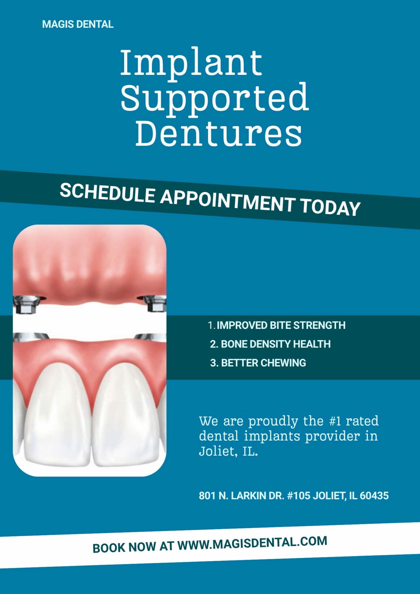 Implant Supported Dentures at Magis Dental In Joliet and Plainfield IL