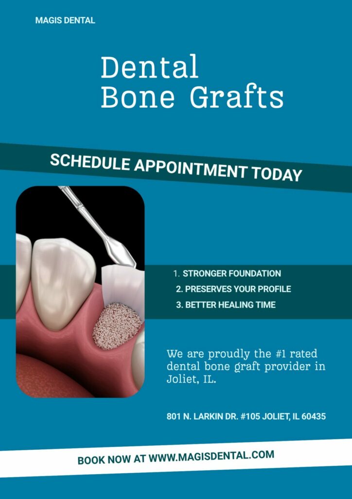 Dental bone grafts in Joliet and Plainfield, IL